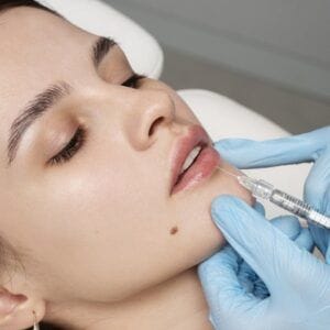 How long do skin booster injections last?