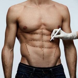 Is Liposuction Haram In Islam?