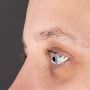 How Long Do Eyebrow Transplants Last?
