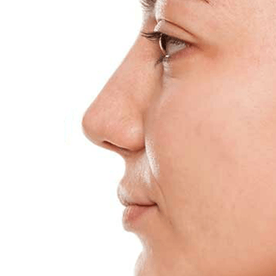 Is Silicone Safe for a Nose Job?