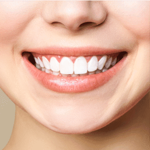 Can Yellow Teeth Be Whiten Again?