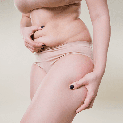 Does Liposuction Tighten Loose Skin?