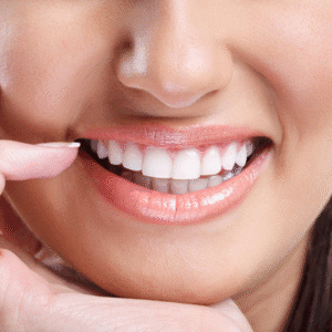 What is the Safest Method of Teeth Whitening?