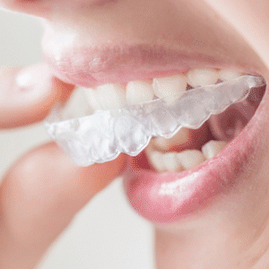 Do Teeth Aligners Really Work?