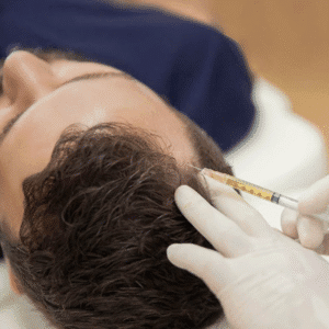 How Long Do Prp Results Last?