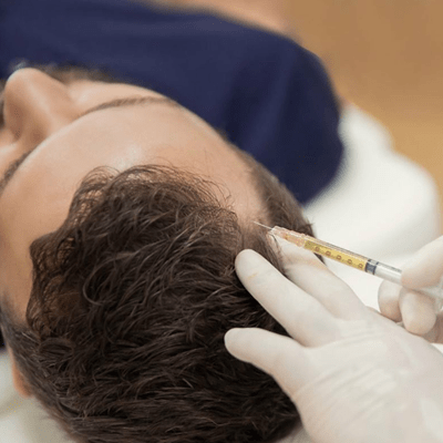 How Long Do Prp Results Last?