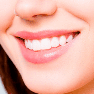 How Long Does a Teeth Whitening Last?