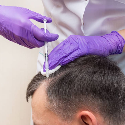 How Long Does PRP Last for Hair?