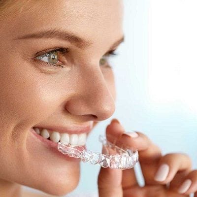 Aligners Cost in Dubai & Abu Dhabi | Clear Aligners