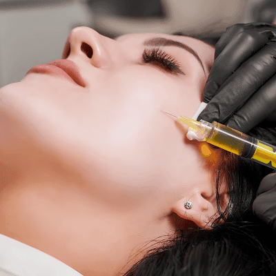 Are Vampire Facial Effective for Dark Circles? 1 Are Vampire Facials Effective for Dark Circles?