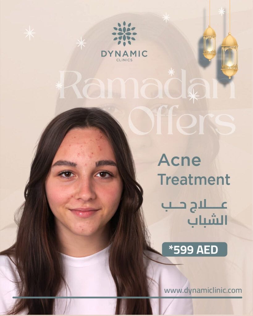 Acne Treatment
