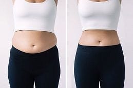 Before and After Weight Loss Injections