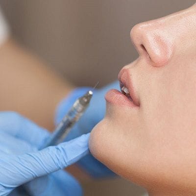 Botox Lip Flip in Dubai