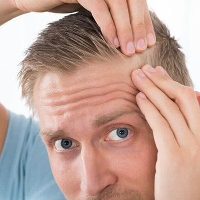 Best FUE Hair Implant in Dubai, Abu Dhabi & Sharjah | Cost