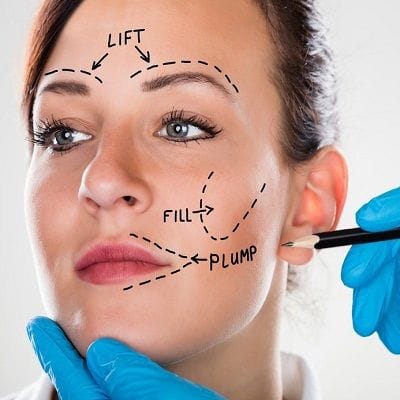 Best Facelift Surgeon