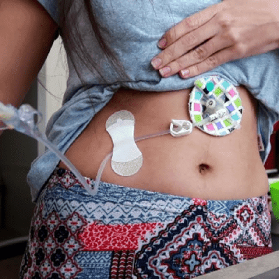Best Home Enteral Nutrition Options in Dubai 1 Best Home Enteral Nutrition Options In Dubai