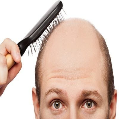 Best Treatment For Hair That’s Falling in Dubai 1 Best Treatment For Hair That’s Falling in Dubai, Abu Dhabi & Sharjah