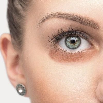 Best Under Eye Dark Circle Treatment