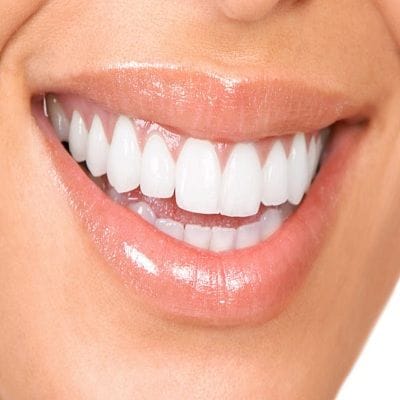 How Many Sessions Does ZOOM Teeth Whitening Take