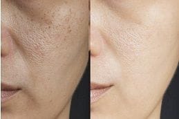 Gluta Drip in Dubai & Abu Dhabi 8 Best gluta-drip-in-dubai Clinic in Dubai
