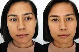 Gluta Drip in Dubai & Abu Dhabi 12 Best gluta-drip-in-dubai in dubai