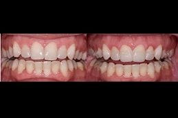 Best laser-dentistry in Abu Dhabi