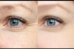 Skincare Treatments 4 Best skincare-treatments in Abu Dhabi