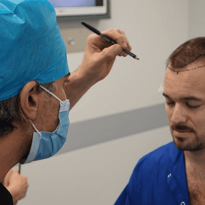 Biofibre Hair Transplant 1 Biofibre Hair Transplant