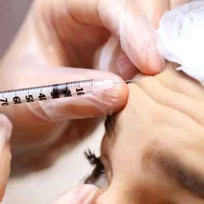 Botox Injections for Migraine Headache