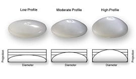 Safety And Breast Implant: Can They Co-Exist? 3 Breast Implant Size in Dubai- Dynamic clinic Dubai
