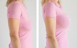 Best Breast Reduction Clinic Dubai 9 breast reduction surgery clinic in dubai