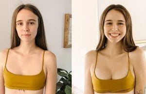 Breast Surgery Clinic in Dubai 7 Breast Surgery Clinic in Dubai & Abu Dhabi