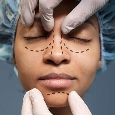 Breathe Easy and Look Great with Rhinoplasty 1 Breathe Easy and Look Great with Rhinoplasty