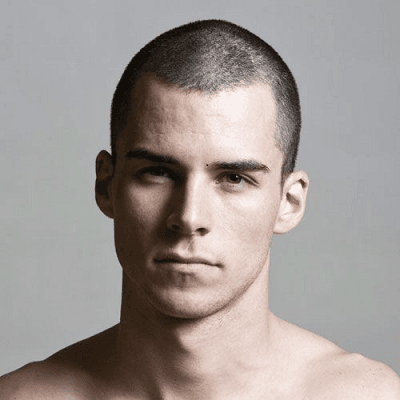 Can Bald Men Really Regrow Hair In Dubai? 1 Can Bald Men Really Regrow Hair In Dubai