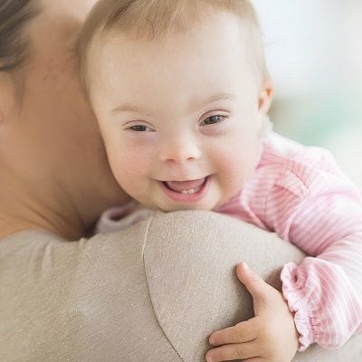 Can Congenital Anomalies Cause Lifelong Disabilities?