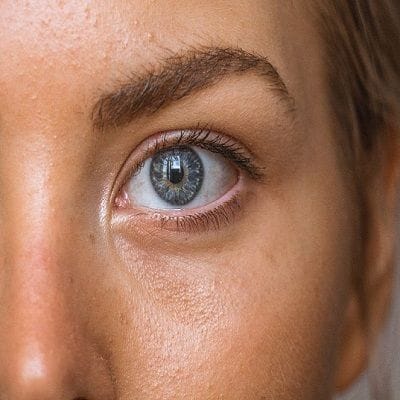 Can Ultherapy be Used Under Eyes