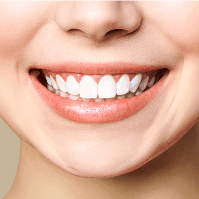 Can Yellow Teeth Be Whiten Again? 1 Can Yellow Teeth be Whiten Again?