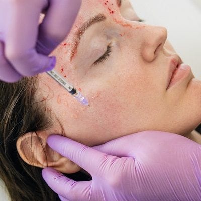 Can a Vampire Facial Make You Look Younger? 1 Can a Vampire Facial Make You Look Younger?