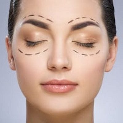 Causes of Droopy Eyelids 1 Causes of Droopy Eyelids