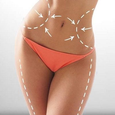 Cheapest Waist Sculpting in Dubai 1 Cheapest Waist Sculpting in Dubai UAE & Abu Dhabi | Waist Sculpting Cost