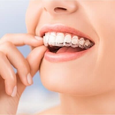 Cost of Dentofacial Orthopedics In Dubai dentofacial orthopedics