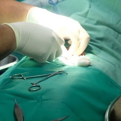 Cost of Male Circumcision Surgery in Dubai
