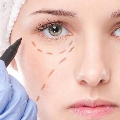 Dark Circle Treatment Cost