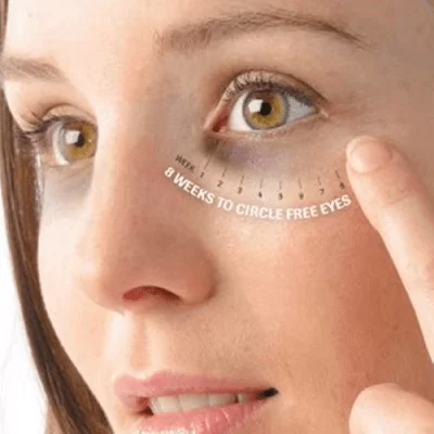 Dark Circle Post-Op Care