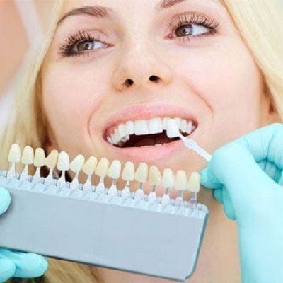 Dental Implants in Dubai