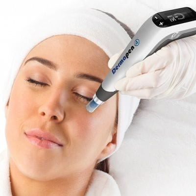 Dermapen Treatment – Keep Looking Young