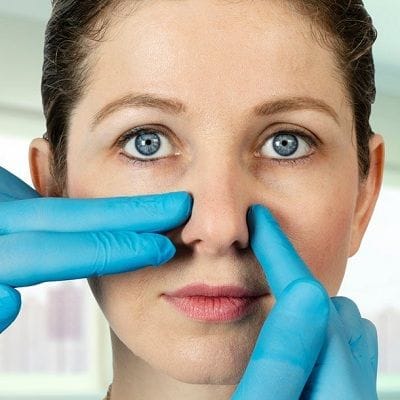 Deviated Nasal Septum Surgery in Dubai & Abu Dhabi Dynamic Clinic
