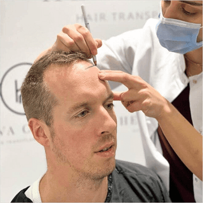 Direct Hair Implantation (DHI) Risks, Danger and safety