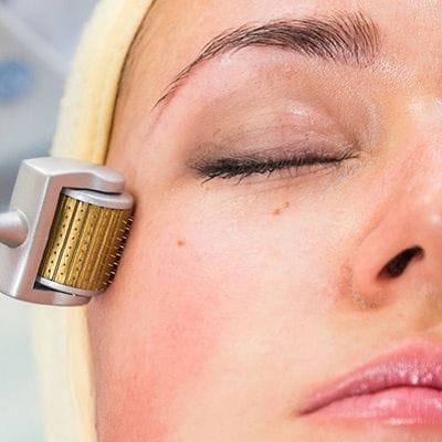 Discover the Benefits of Derma Rollers Treatment 1 Discover the Benefits of Derma Roller Therapy