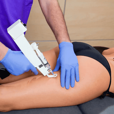Does Mesotherapy Work For Cellulite On The Legs? 1 Does Mesotherapy Work For Cellulite On The Legs?